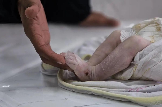 وفاة طفل رضيع بعمر شهر نتيجة البرد القارس في غزة