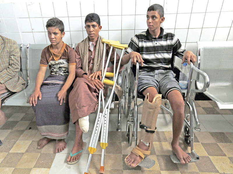 صبية يمنيون ينتظرون العلاج في مركز إعادة تأهيل بصنعاء أمس (إي بي إيه)