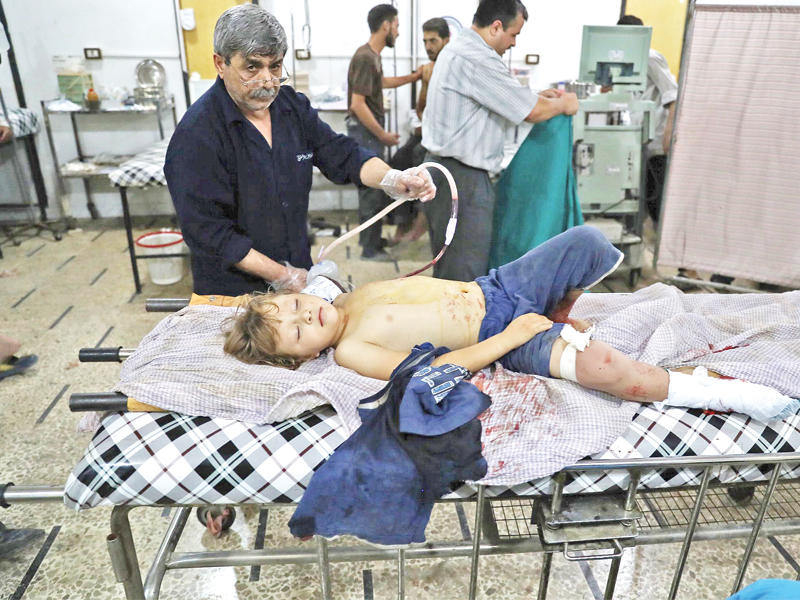 صبي سوري  يتلقى العلاج في مستشفى مؤقت في دوما أمسt(أ ف ب)