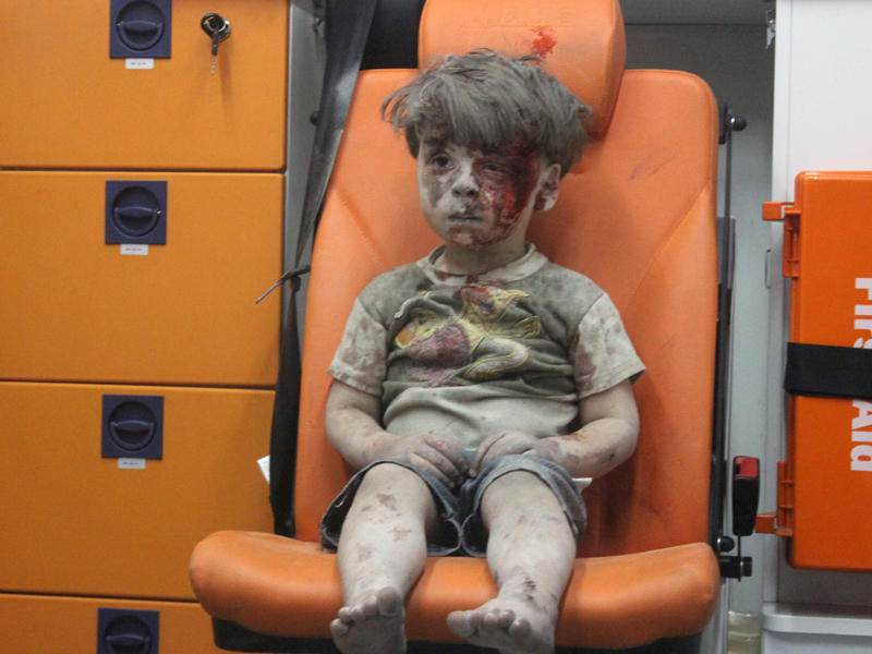 الطفل السوري عمران