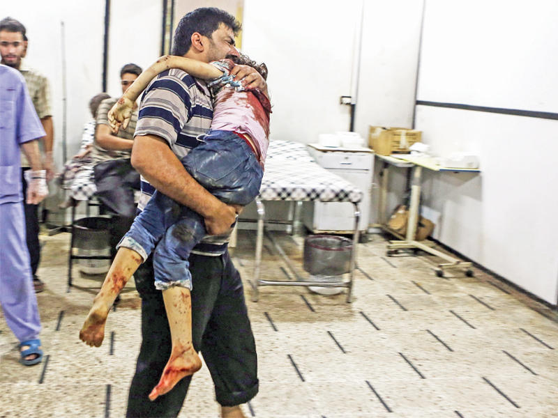 سوري مفجوع بإصابة ابنته في هجوم جوي على دوما أمس (إي بي إيه)