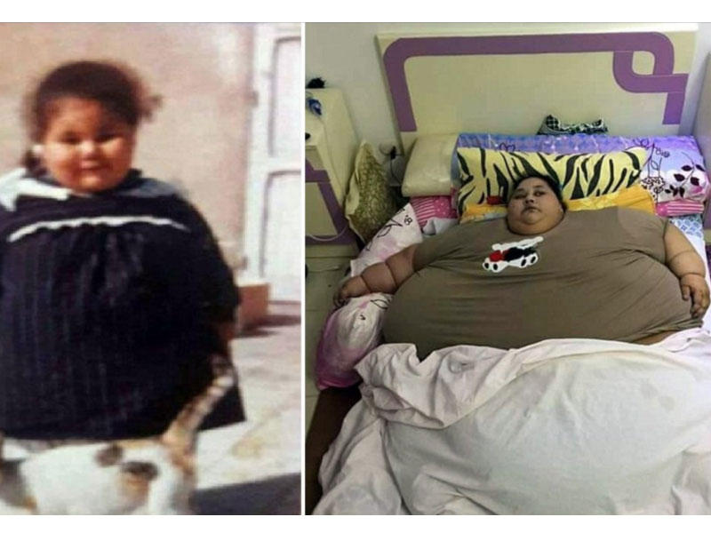 إيمان أحمد تحمل لقب أثقل امرأة في العالم،