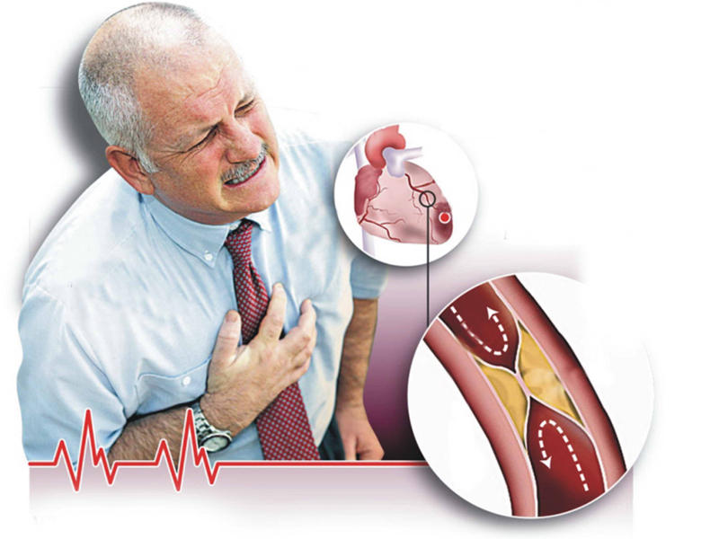  أمراض القلب و الدهون