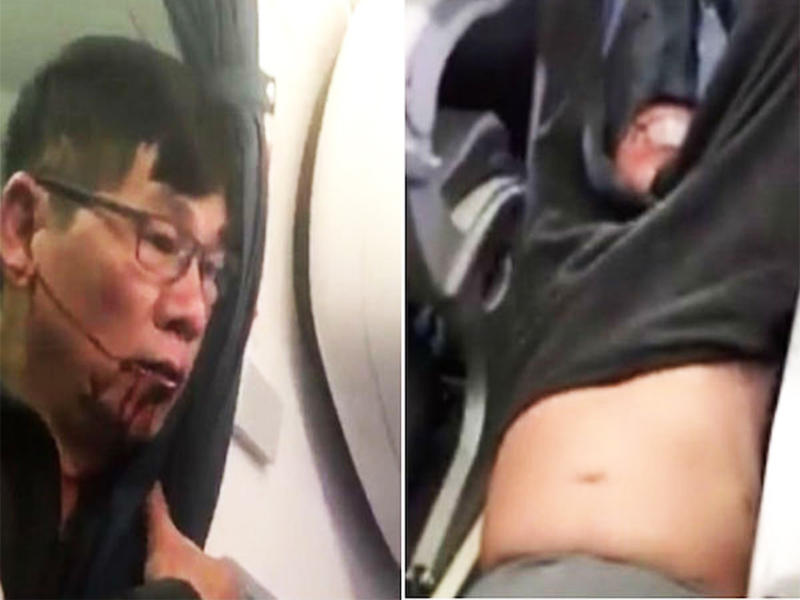 ديفيد داو أصيب بكسر في الأنف وإرتجاج دماغي بعد أن سحل بالقوة