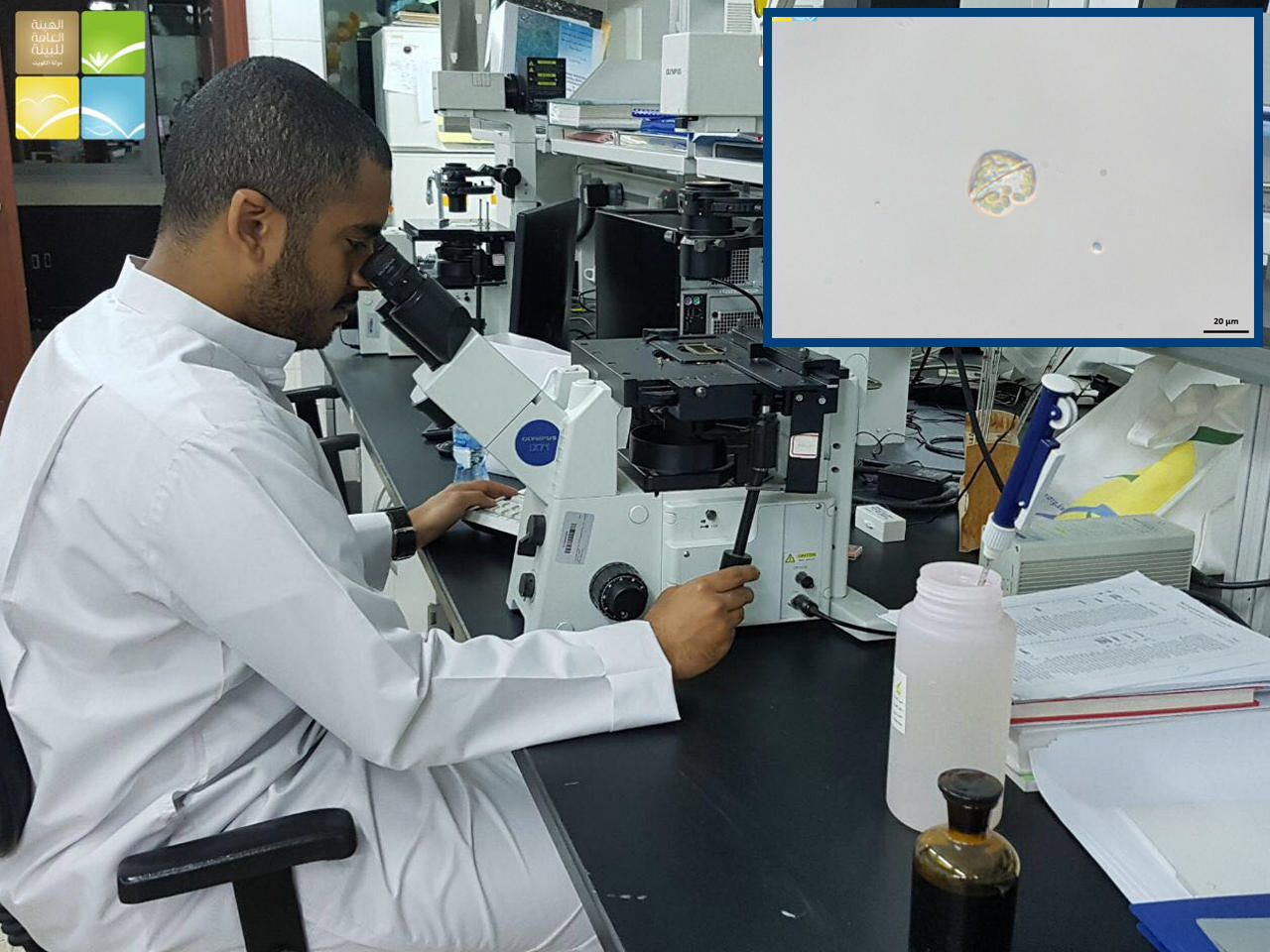 التحاليل البيولوجية للبقعة الظاهرة مقابل ميناء الشويخ