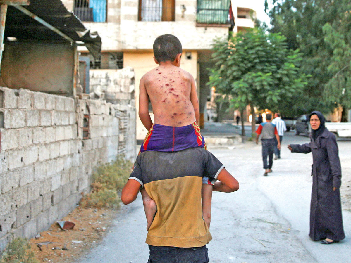 سوري يحمل صبياً تغطي ظهره شظايا في بلدة عربين أمس الأول (رويترز)