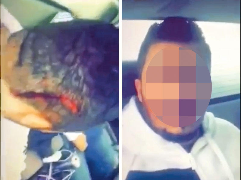 المتهم والأصابة التي لحقت به