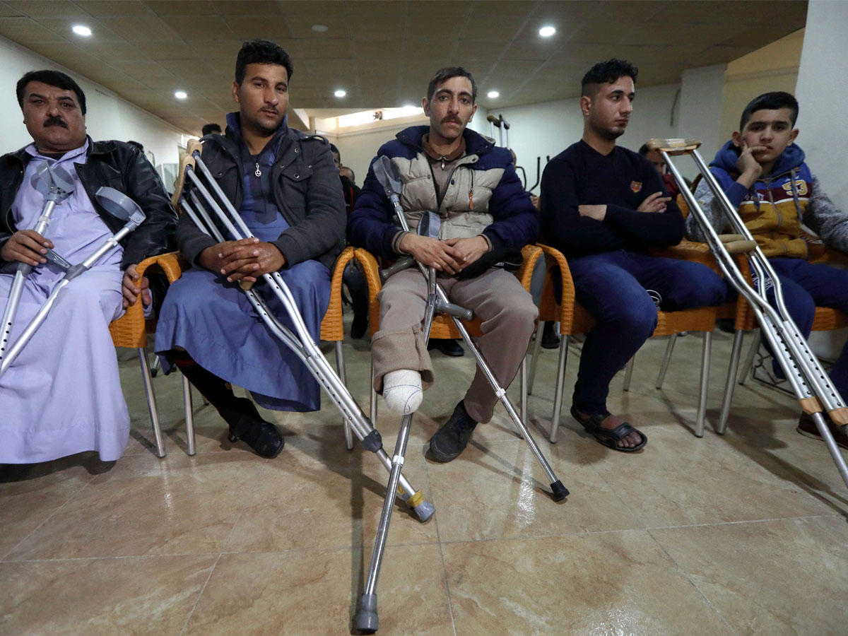 عراقيون فقدوا اطرافهم خلال معركة الموصل يحصلون على اطراف صناعية بتمويل من الكويت أمس الأول في أربيل أمس الأول (أ ف ب)