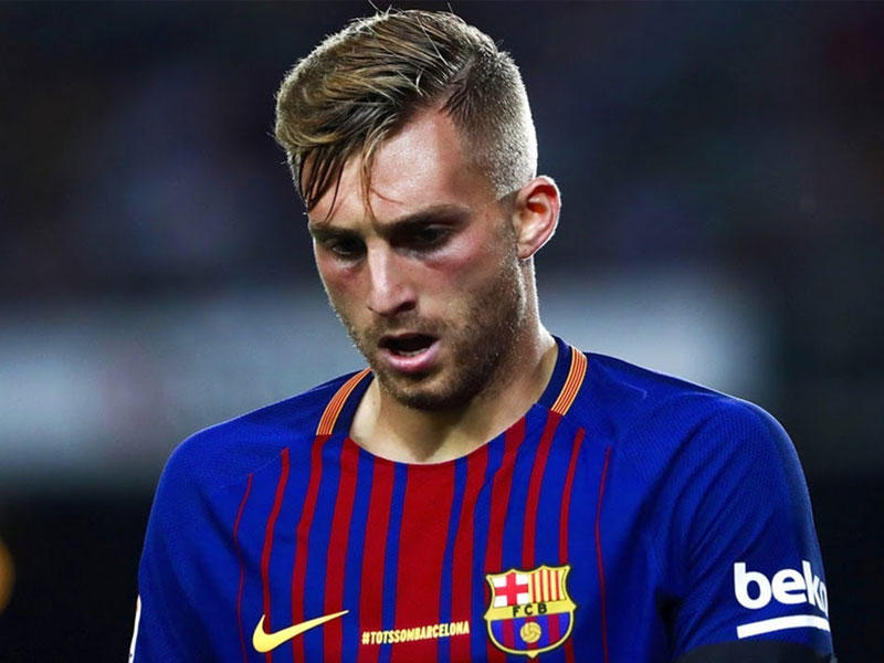 جيرارد ديلوفيو