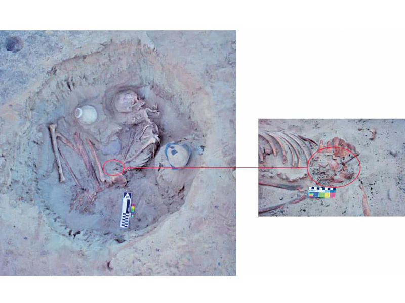 الدفنة الأثرية ويظهر فيها الجنين في جوف أمهn
