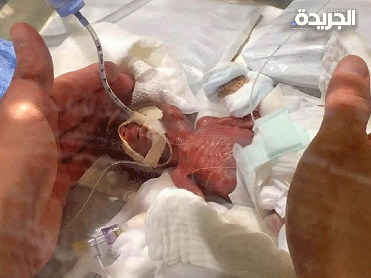 أصغر طفل في العالم