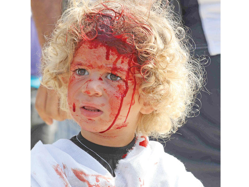 طفل لبناني ينزف أمس بعد خضوعه للتطبير وهي عادة تشتهر بها مدينة النبطية جنوب لبنان تقوم على ضرب الجبين بشفرة حادة في ذكرى العاشر من المحرم (أ ف ب)n