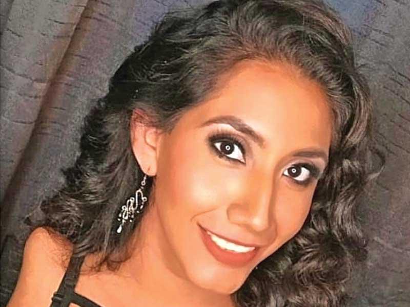 عارضة الأزياء المكسيكية آنا مولينا