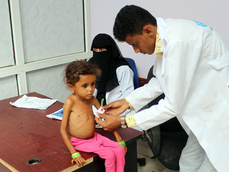 فتاة يمنية تعاني من سوء التغذية يتم وزنها في عيادة في محافظة حجة شمال اليمن