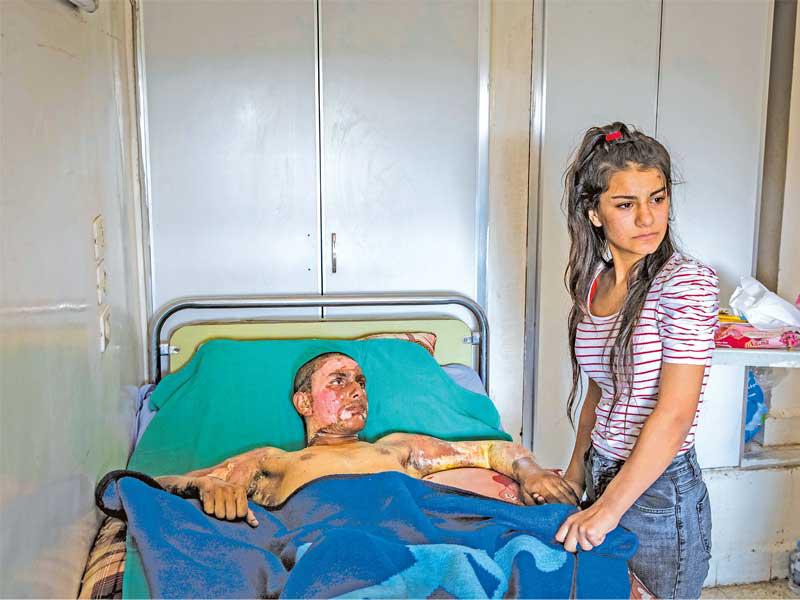 صورة مرشحة للفوز بصورة العام من «ورلد برس» تظهر مقاتلا كردياً سورياً تعرض لحروق تزوره صديقته في مستشفى بالحسكة في 20 الجاري (رويترز)