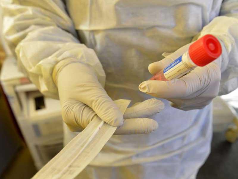 وزارة الصحة تجري 179 ألف مسحة لفيروس كورونا