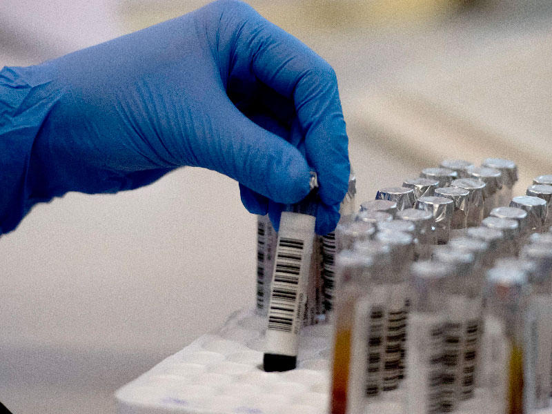 إصابة 99 مواطناً بـ عدوى فيروس كوروناn