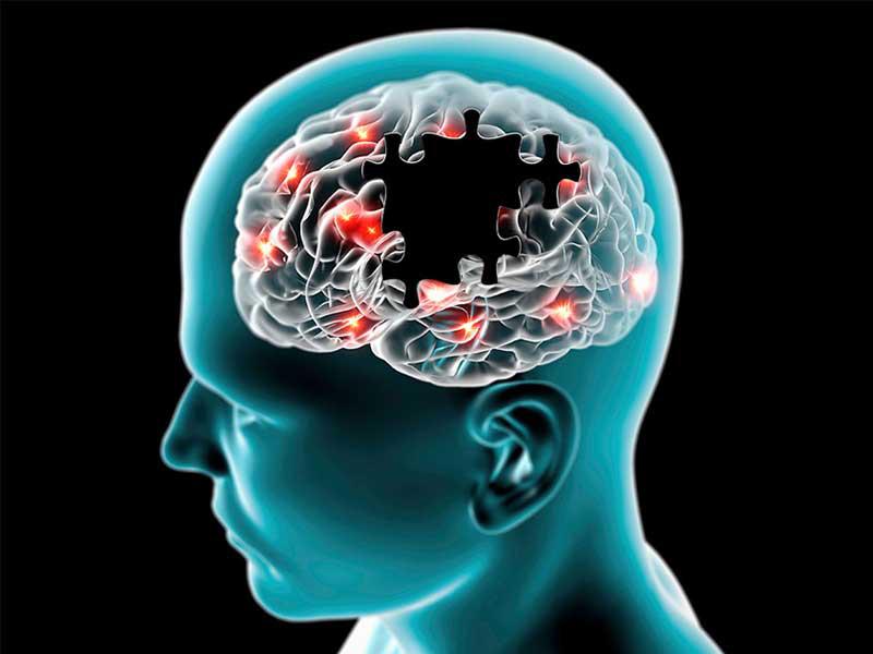 علاج جديد لمرض الباركنسون