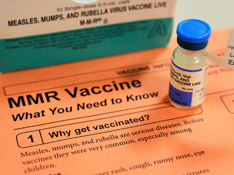  لقاح الحصبة والنكاف والحصبة الألمانية