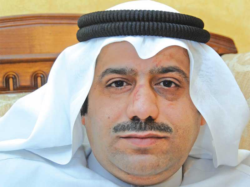 أمين السر العام في نادي الجهراء، خلف السهو