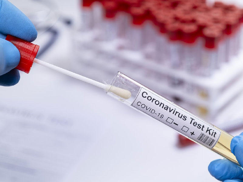 845 إصابة بفيروس كورونا... والمواطنون ربع المصابين