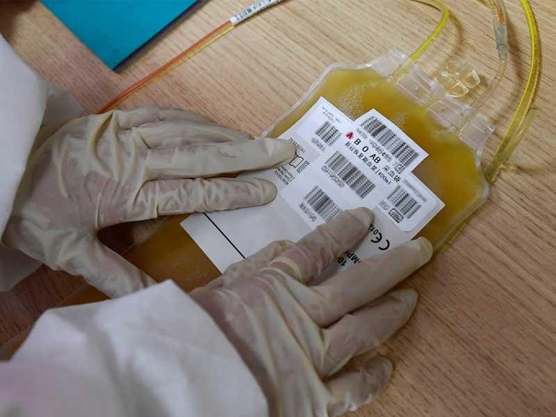 بلازما دم المتعافين من مرض فيروس كورونا يعالج شريحة العناية المركزة والحالات الحرجة