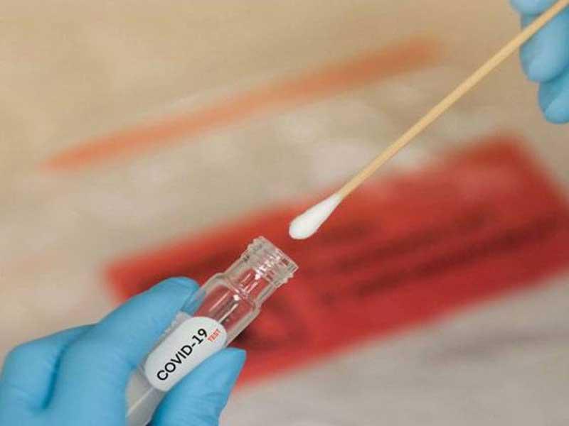 المسحة الانفية تعد احد انجح طرق الكشف عن فيروس كورونا 