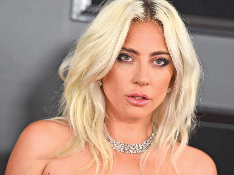 النجمة العالمية ​ليدي غاغا​