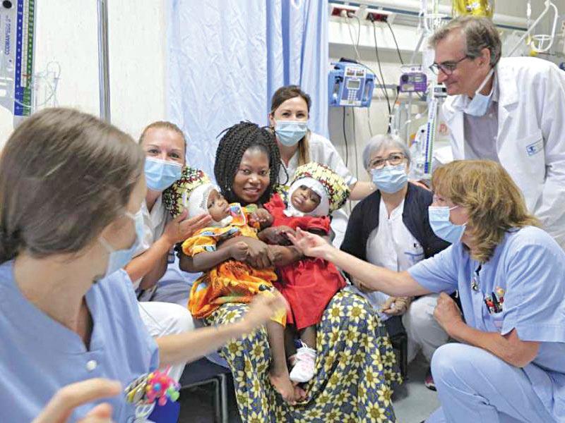 فصل توأمين بجمجمة واحدة بنجاح 