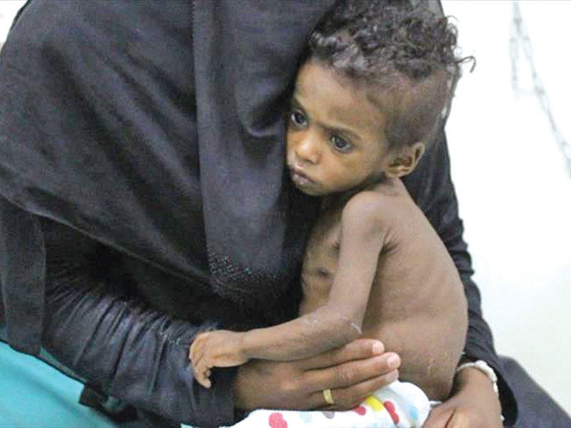 المجاعة تهدد 10 ملايين يمني