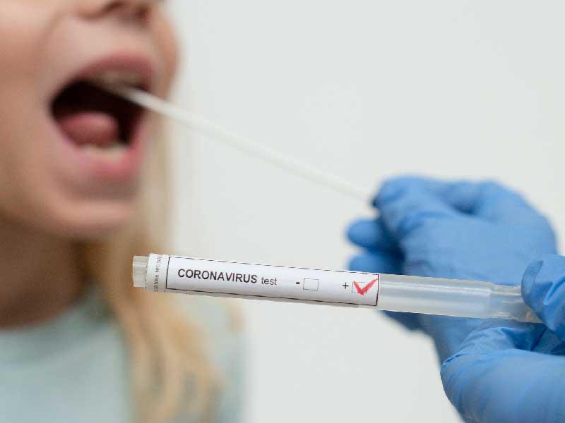 فحص كورونا بواسطة لعاب الفم