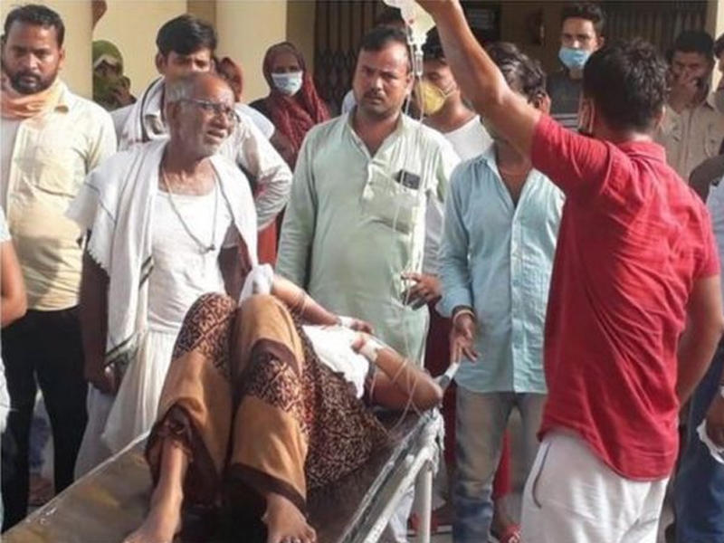 المرأة المصابة بعد اصابتها من قبل زوجها