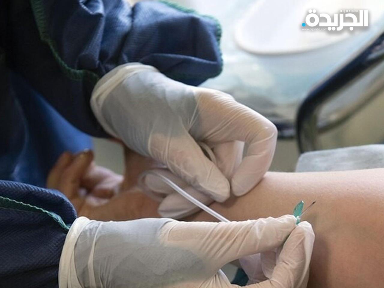 البرازيل تعيد السماح بالتجارب السريرية للقاح الصيني n