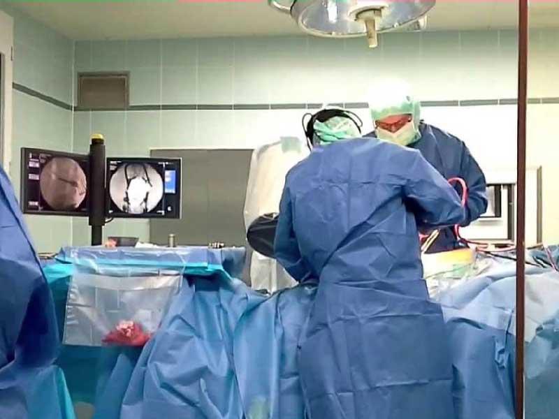 إزالة شعر من معدة فتاة