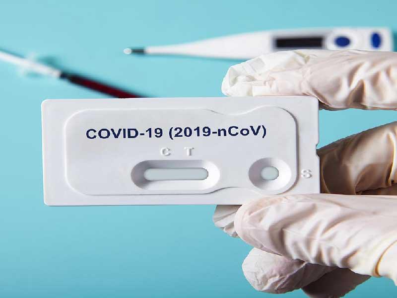 اختبار فيروس كورونا
