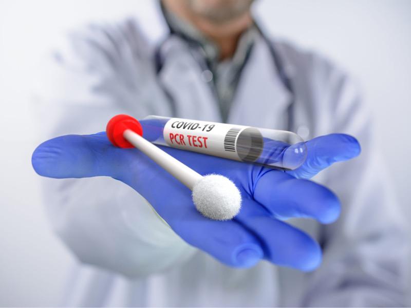 اختبارات الكشف عن كورونا
