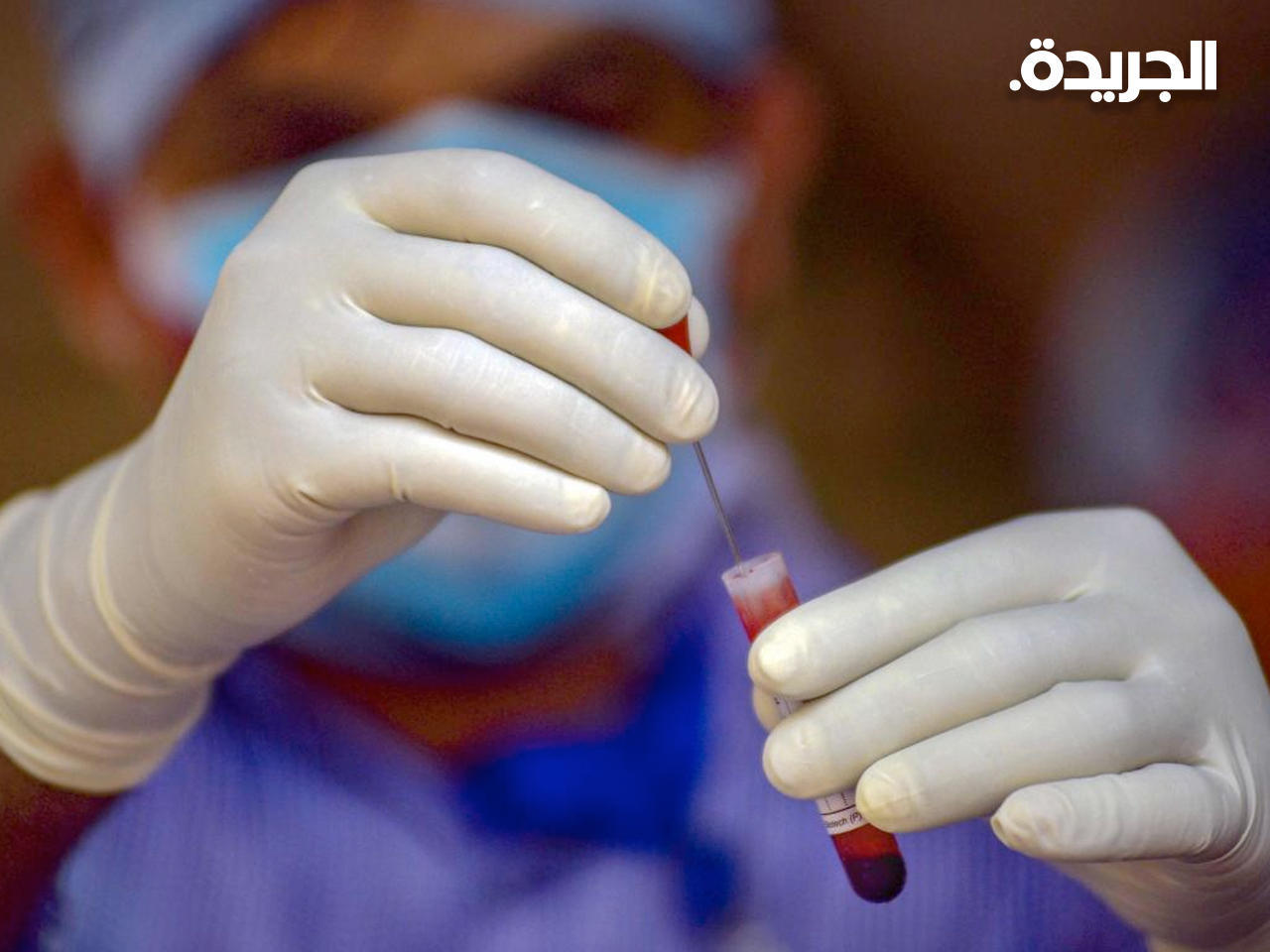 وفاة دنماركية بجلطات دموية بعد تلقيها لقاح أسترازينيكا