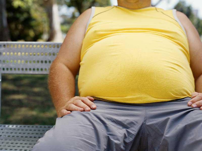سمنة مفرطة
