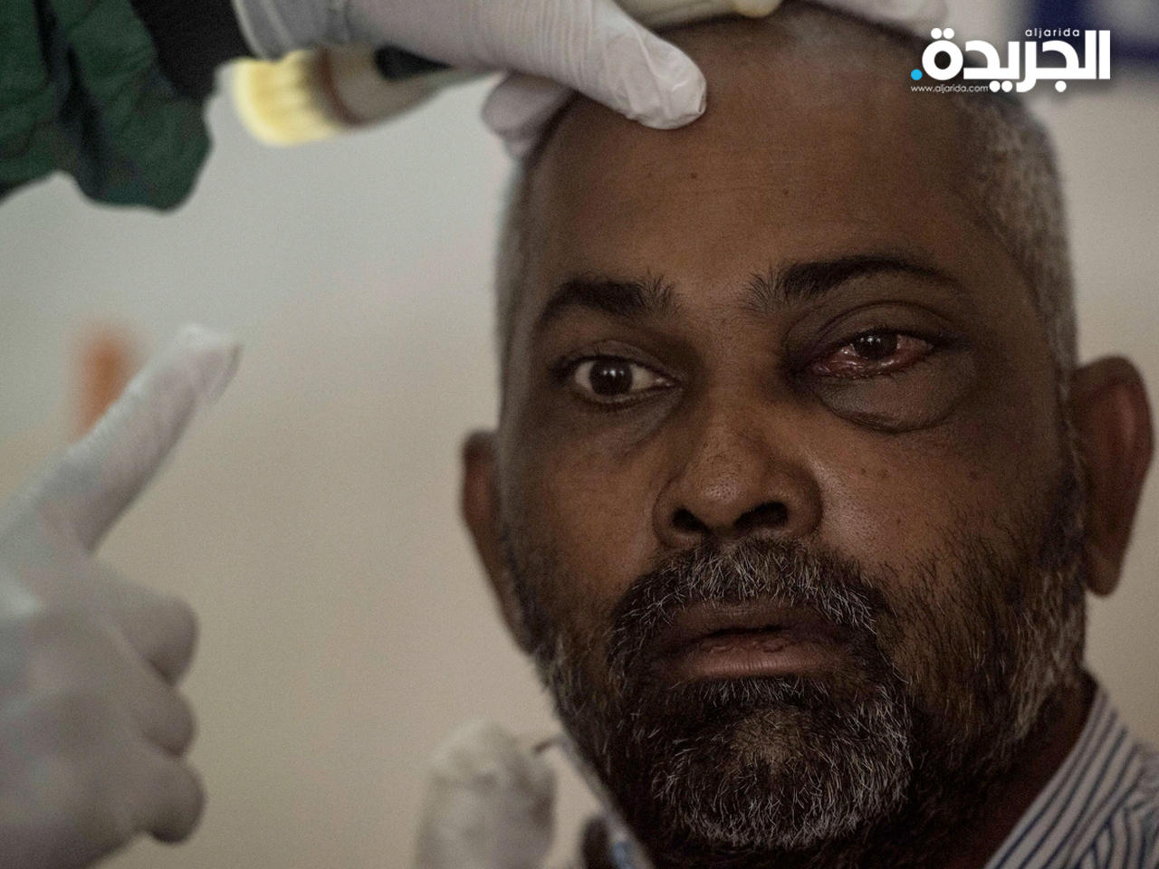 الفطر الأسود.. مصدر قلق جديد