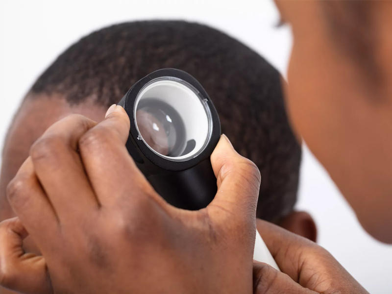 فحص جلد الرأس