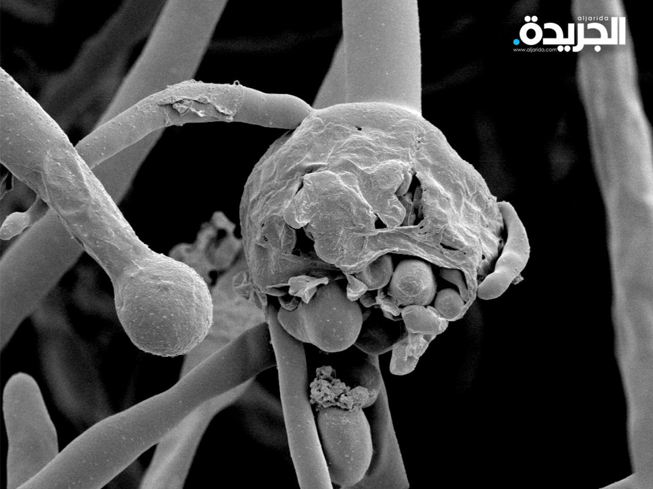 تونس تسجل أول حالة إصابة بمرض الفطر الأسود