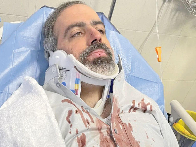 الفنان عبدالله التركماني