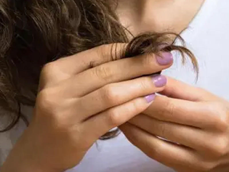 مهووسة بأكل الشعر