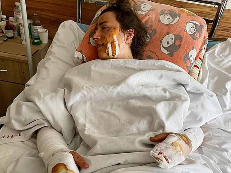 العروس المصابة ترقد في المستشفى