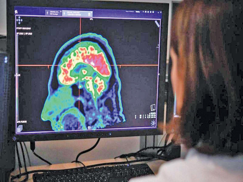 واشنطن تتعهد بحل لغز «متلازمة هافانا» n