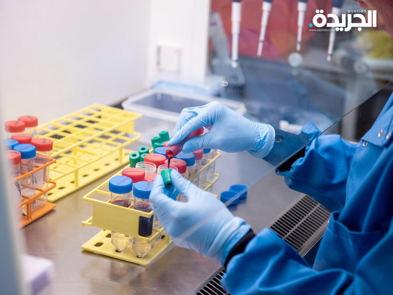 «أكسفورد» تطور لقاح جديد لفيروس إيبولا