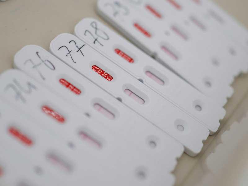  الاختبارات السريعة المستخدمة في مركز اختبار مرض فيروس كورونا 