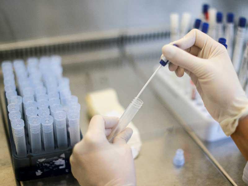 فحص عينات عشوائية للكشف عن السلالة الجديدة