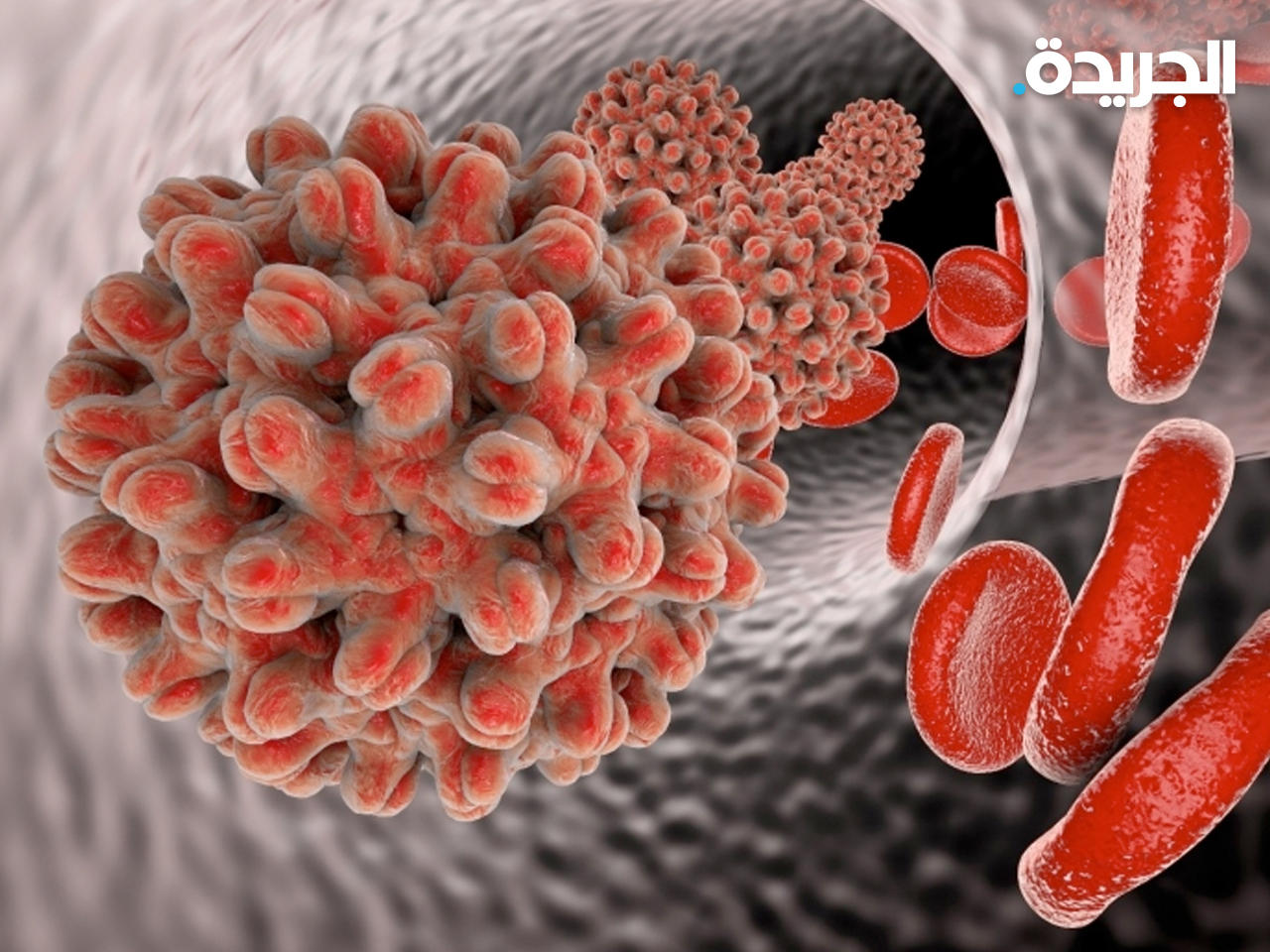 مرض الحزام الناري