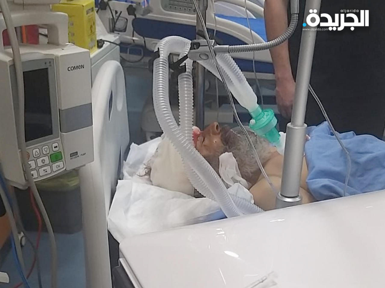 المسن المدهوس يتلقى العلاج في المستشفى